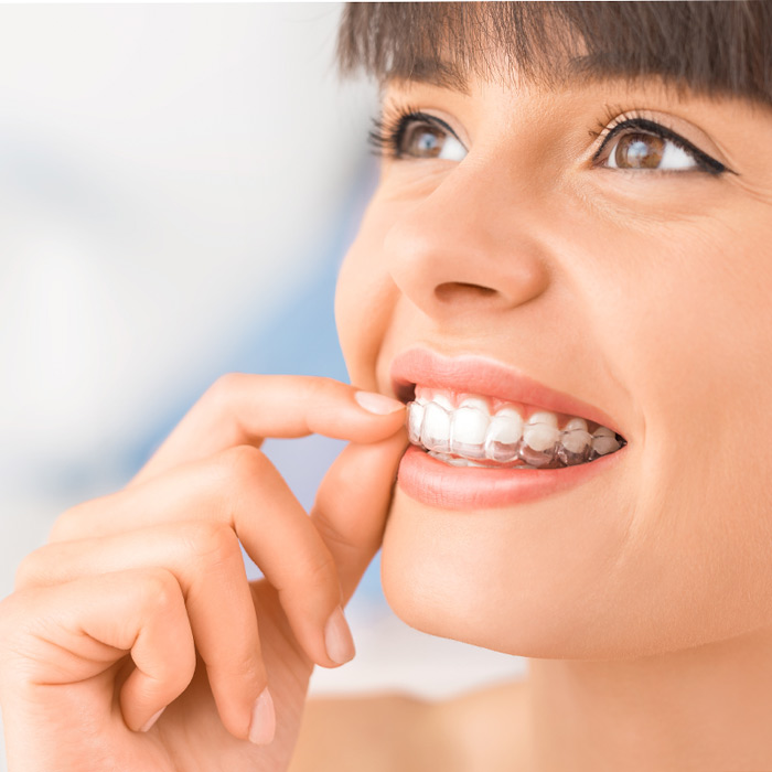 ¿Brackets para dientes? Invisalign en Panamá - Clínica Dental Champsaur
