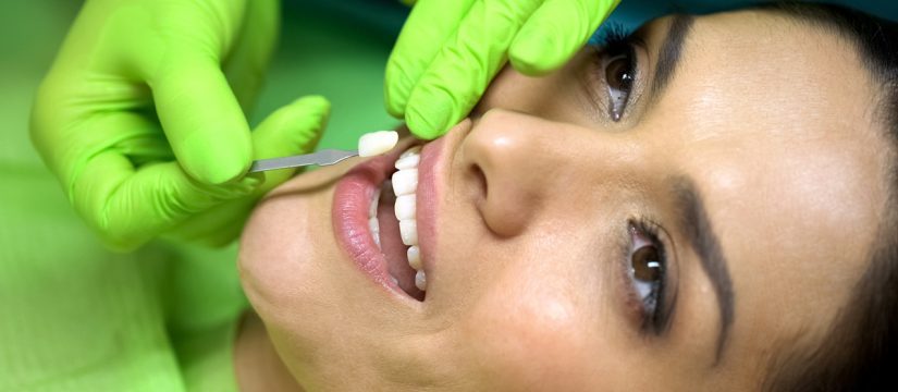 Veneer Dentist Panama