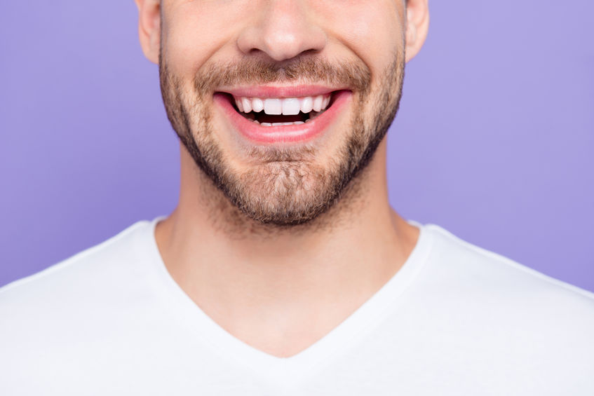 Cosmetic dental veneers Panama