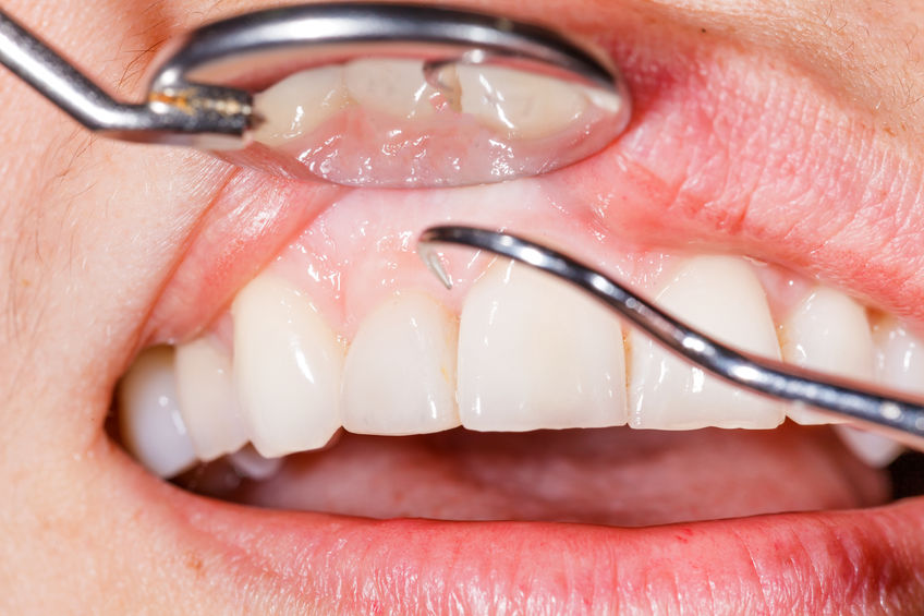 Where to perform a periodontal treatment in Panama