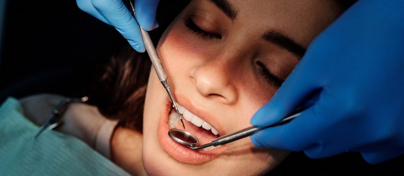 What Are Dental Veneers Used For?