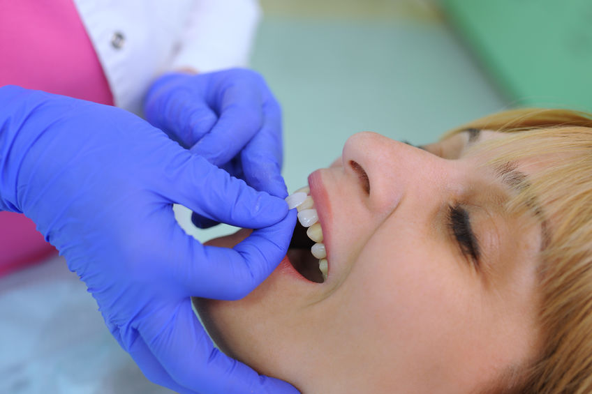 On average how much is teeth whitening