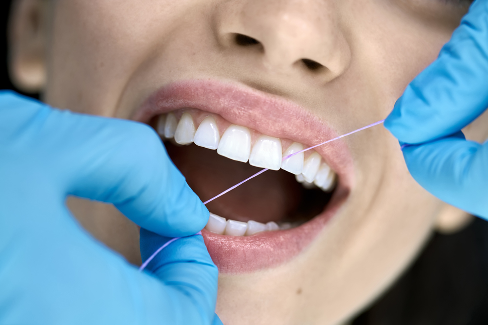 ¿Es Importante la limpieza dental?