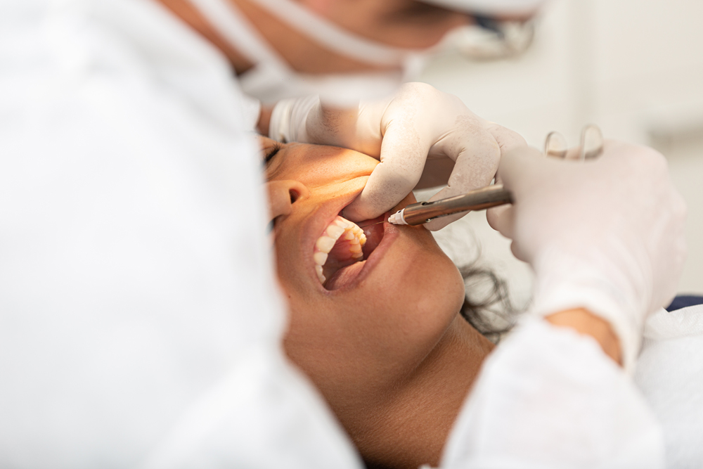 When should wisdom teeth be removed?
