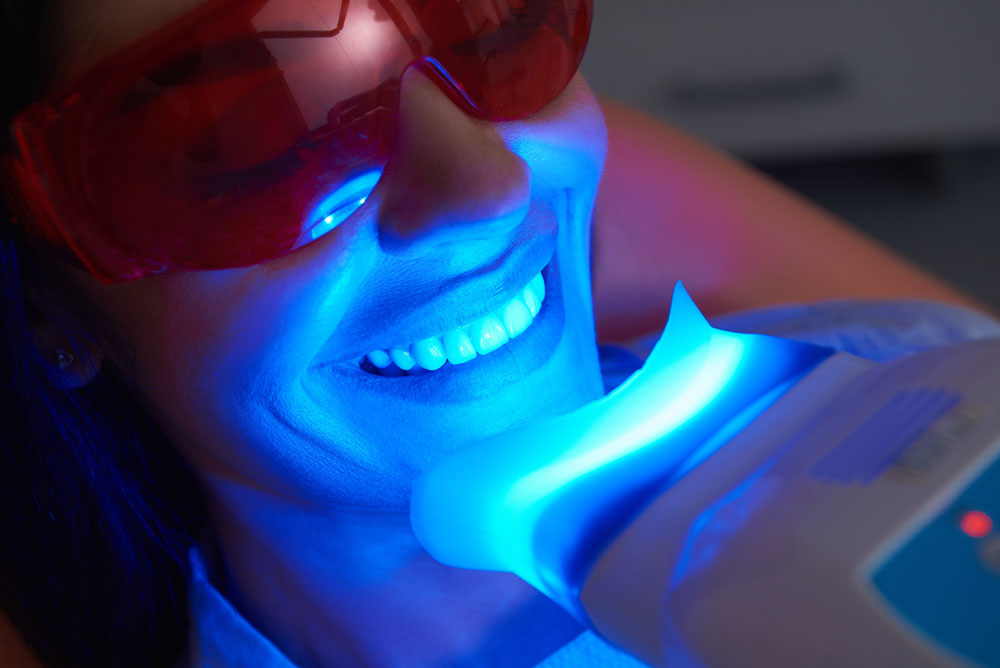 Limpieza dental y blanqueamiento Panama