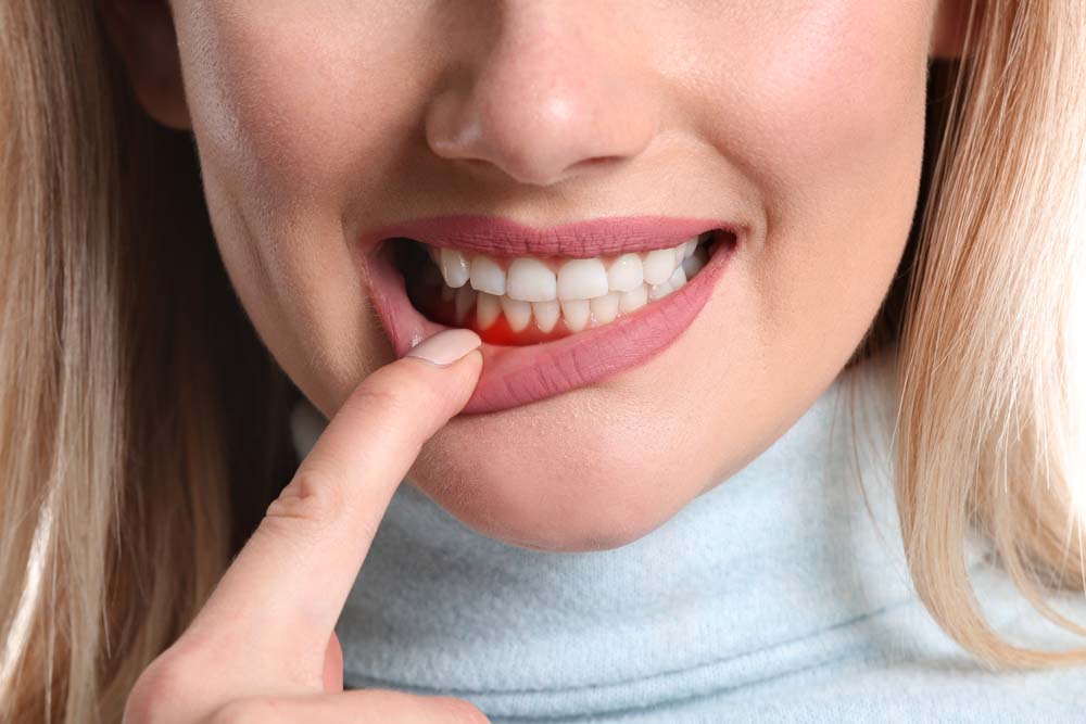 What is periodontal surgery?